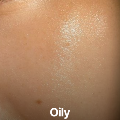 Oily