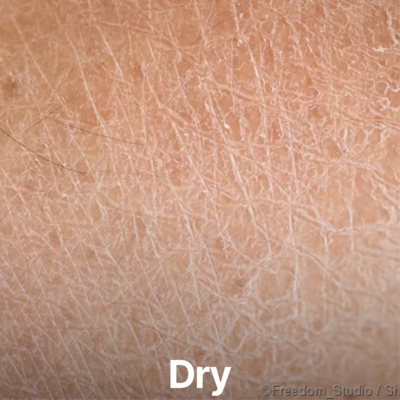 Dry
