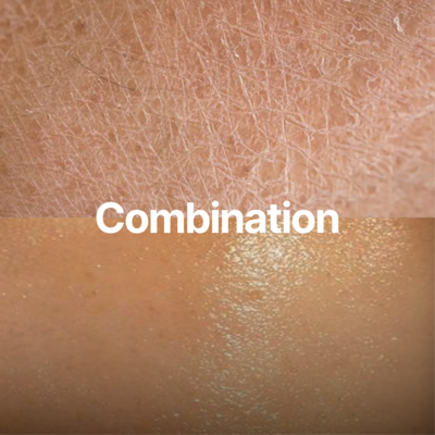 Combination